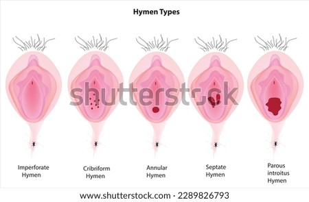 Biological Vector of Hymen Types