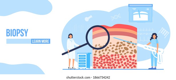 Biopsy of patient concept vector. Oncologist concept vector for app, web, blog. Tiny doctors of oncology treat patient and fight with cancer.