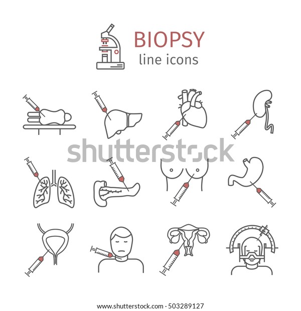 Biopsie Arten Von Biopsie Verfahren Zur Krebsdiagnose Stock Vektorgrafik Lizenzfrei
