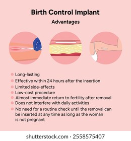 Birth control implant, advantages and disadvantages