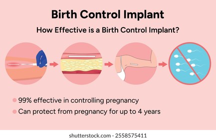 Birth control implant, advantages and disadvantages