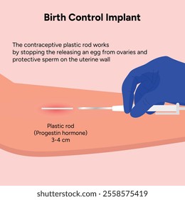 Birth control implant, advantages and disadvantages