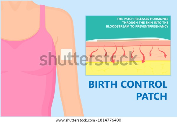 Birth Control Patch to
prevent pregnancy