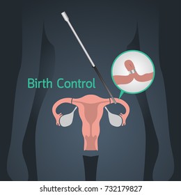 Birth Control vector logo icon illustration
