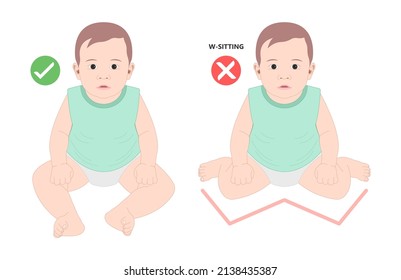 Birth infant genu valgum varum criss cross and club foot tailor body side W Sitting wrong bad position of bent hip Bow leg knock knees in core kids children baby back pain poor toed walking