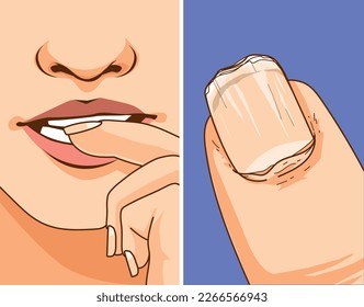 Biting the nail. Damaged nail. Bad habit. Healthcare illustration, vector illustration. 