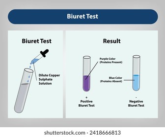 Der Biuret-Test, auch Piotrowskis Test genannt, ist ein chemischer Test, der verwendet wird, um das Vorhandensein von mindestens zwei Peptid-Bindungen innerhalb eines Moleküls zu ermitteln. Vektorgrafik.