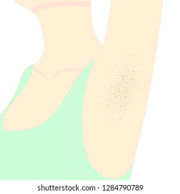 Black armpits and dark spots. Pores, skin problems.
