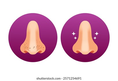 Black Dots on the Nose, Before and After,Healthy Skin and Clean nose