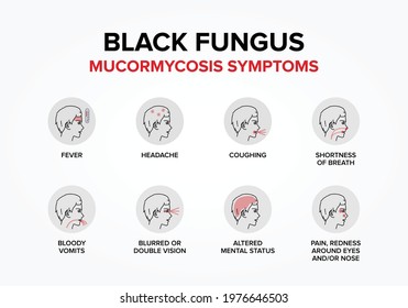 Black Fungus Or Mucormycosis Symptoms.