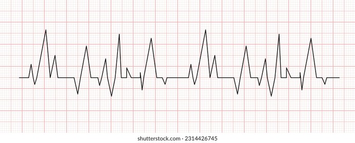 Schwarzes Herzschlag-Diagramm auf rotem Graphen-Papier. Elektrokardiogramm-Linie. Herzrhythmus oder Herz-Kreislauf-Testzeichen. Krankenhaussymbol für Kardiologie. Vektorgrafik-Illustration