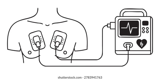 Black outline of electrocardiogram machine attached to patient chest, illustration. concept of medical device, heart monitoring, healthcare equipment, icon, diagnostic tool.