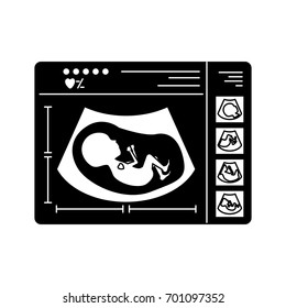 black silhouette of monitoring ultrasound of baby in device vector illustration