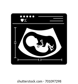 black silhouette of ultrasound of baby vector illustration