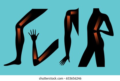 Black silhouettes of hands, legs and torso with a symbolic image of problems with joints in the form of a broken board