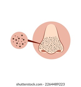 black spots on the nose, black dot nose