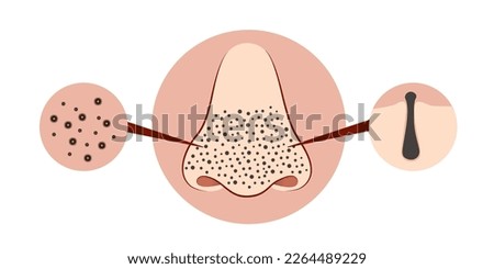 black spots on the nose, black dot nose