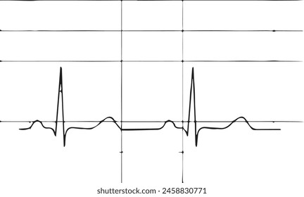 black and white electrocardiogram reading