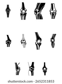 Vetor preto e branco conjunto de silhuetas de anatomia articular do joelho em diferentes ângulos. Ideal para design médico, ortopédico e educacional.