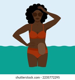 Black woman with colostomy bag on sea holiday