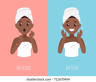 Black woman skin care. Before and after face treatment. Facial skin problems flat illustration