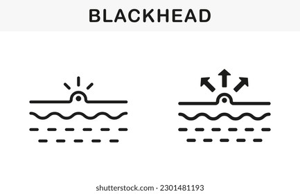 Blackhead, Skin Acne, Comedo Line and Silhouette Black Icon Set. Pimple and Inflammation Sebum Pictogram. Deep Dirty Pore, Skin Problem Symbol Collection. Isolated Vector Illustration.