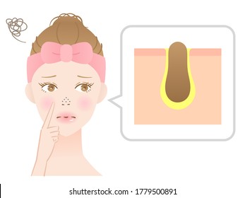 blackheads on beautiful female face with skin diagram. Isolated on white background