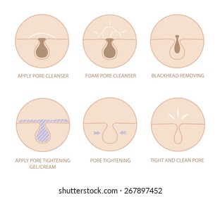 Blackheads removing and pore cleansing symbols set.