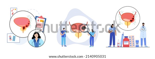 Bladder cancer stages. Doctors consultation\
and treatment in clinic. Bladder, urethra, lymph nodes and\
prostate. Pain and tumor in human urinary system. Internal organs\
exam flat vector\
illustration.