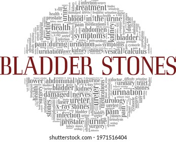 Bladder stones vector illustration word cloud isolated on a white background.