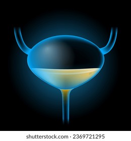 Escalera con orina. Vejiga azul transparente realista sobre fondo oscuro. Sistema urinario humano. Imagen para diseño de atención médica. Ilustración sobre el sistema de excreción. Diagrama de vector