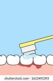 Blank banner Bleeding when brushing illustration vector on blue background. Dental concept.