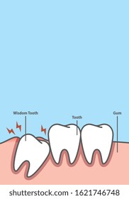 Blank banner Impacted tooth inside under inflammation gum frame cartoon style for info or book illustration vector on blue background. Dental concept.