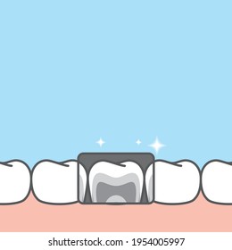 Blank banner lower x-ray healthy hygiene teeth illustration vector design on blue background. Dental care concept.

