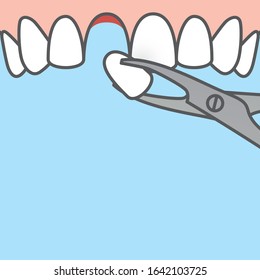 Blank banner Tooth extraction,tooth removal by forceps (upper) illustration vector design on blue background. Dental care concept.