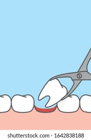 Blank banner Tooth extraction,tooth removal by forceps illustration vector design on blue background. Dental care concept.