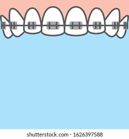 Blank banner Upper Braces teeth illustration vector on blue background. Dental concept.