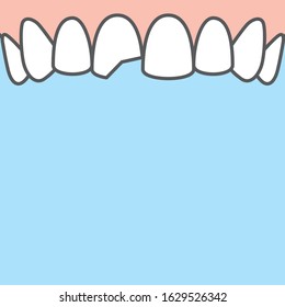 Blank banner Upper Chipped tooth illustration vector on blue background. Dental concept.