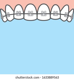 Blank banner Upper clear braces teeth illustration vector on blue background. Dental concept.