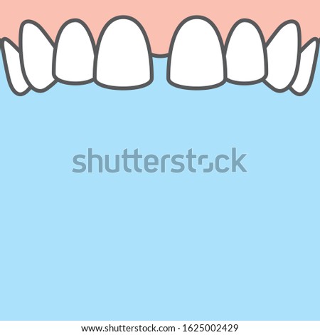 Blank banner Upper Diastema teeth illustration vector on blue background. Dental concept.