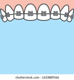 Blank banner Upper metal braces (upper) teeth illustration vector on blue background. Dental concept.