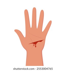 Corte de sangrado en la palma de la mano, situación de emergencia. Tratamiento de primeros auxilios para heridas en la piel. Trauma, procedimiento de tratamiento. Ilustración vectorial