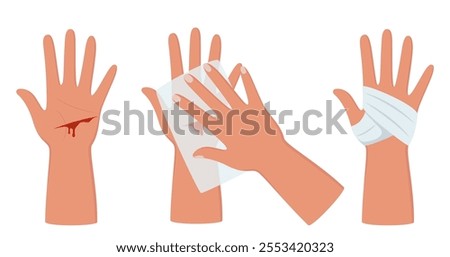Bleeding cut on the palm, emergency situation. First aid treatment for wound on skin. Trauma, treatment procedure. Vector illustration