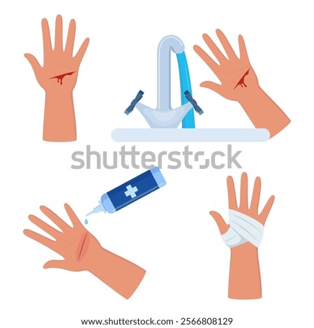 Bleeding cut on the palm, emergency situation. First aid treatment for wound on skin. Trauma, treatment procedure. Vector illustration