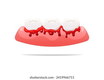 Bleeding teeth and gums vector isolated on white background.