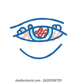 blepharitis disease, redness of eyeball doodle icon sketch vector. blepharitis disease, redness of eyeball sign. isolated symbol illustration