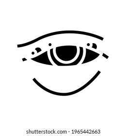 blepharitis disease, redness of eyeball glyph icon vector. blepharitis disease, redness of eyeball sign. isolated contour symbol black illustration