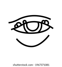 blepharitis disease, redness of eyeball line icon vector. isolated contour symbol black illustration