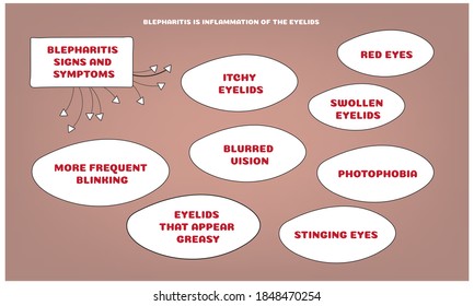 Blepharitis signs and symptoms. Vector illustration for medical journal or brochure. 