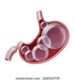 Bloated stomach with gases transparent balls inside. Digestive system bloating problem. Medical illustration . Overeating indigestion and belly disease concept.